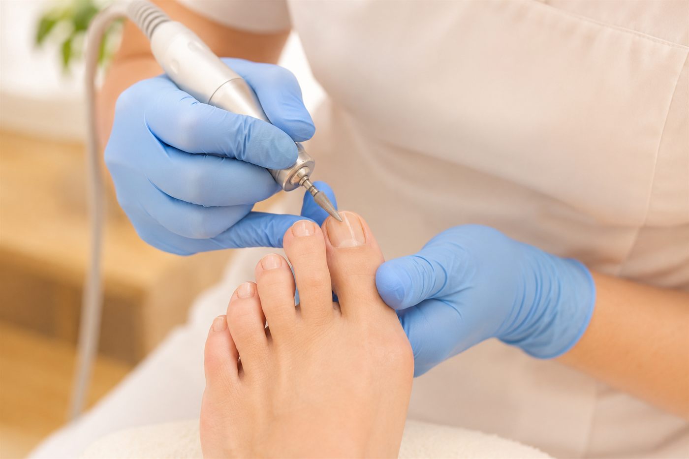 Podologische Behandlung eines Zehennagels